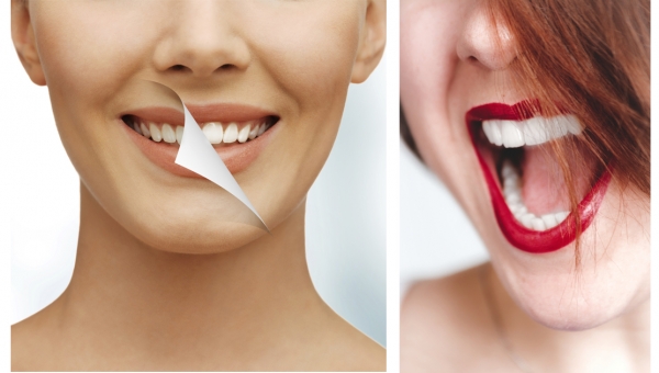 Smile Makeovers Επιλογές θεραπείας